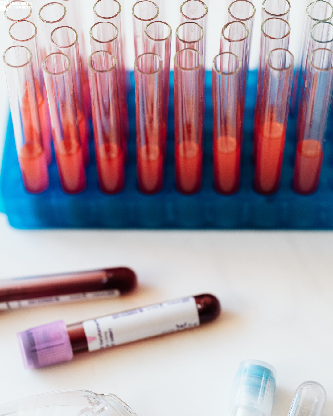 What tests are needed for diabetes