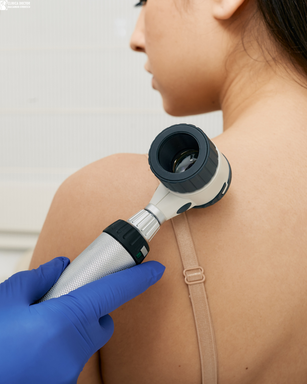 Dermatoscopia– ce este și când este recomandată
