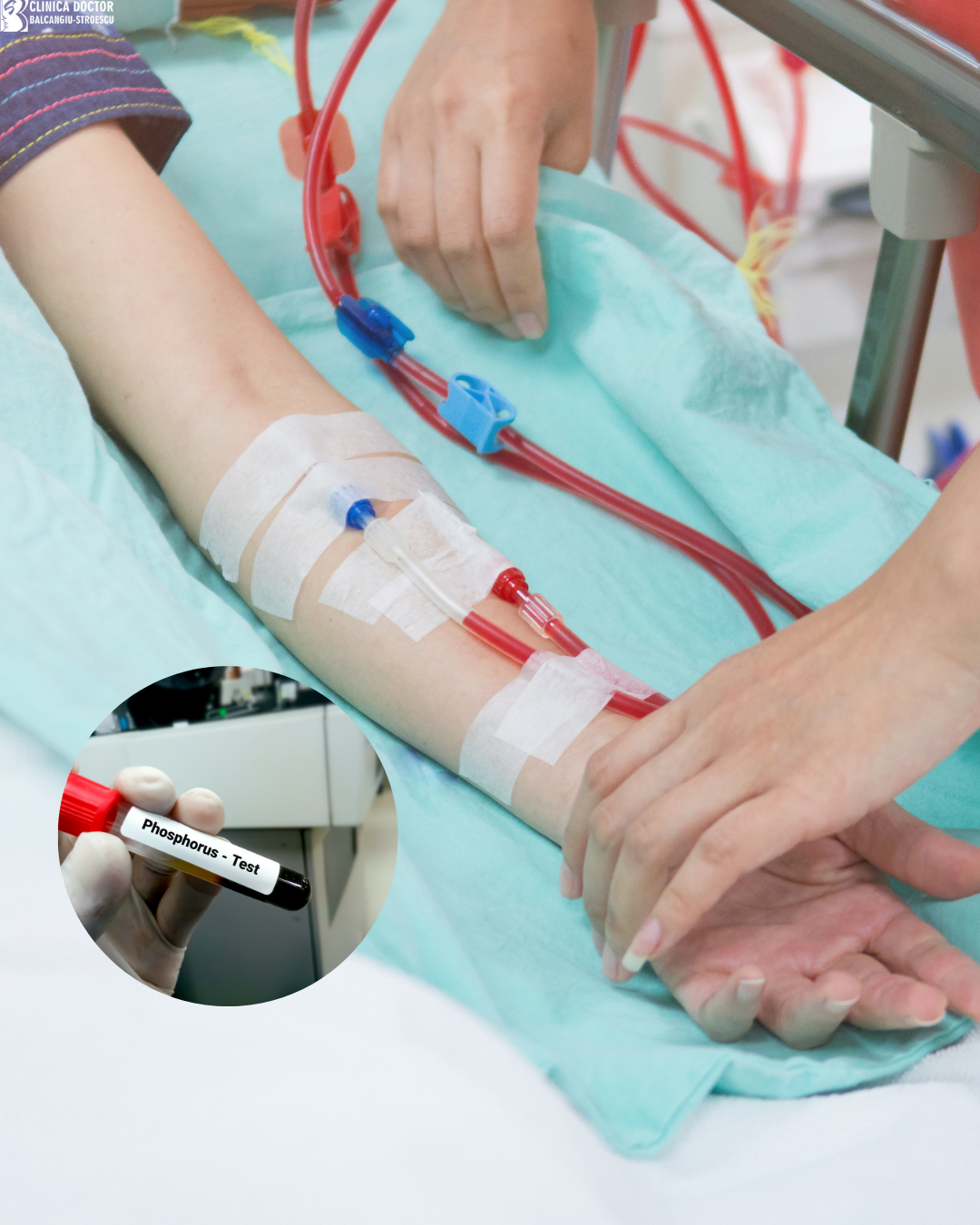 Practical guide for phosphate control in chronic hemodialysis patients