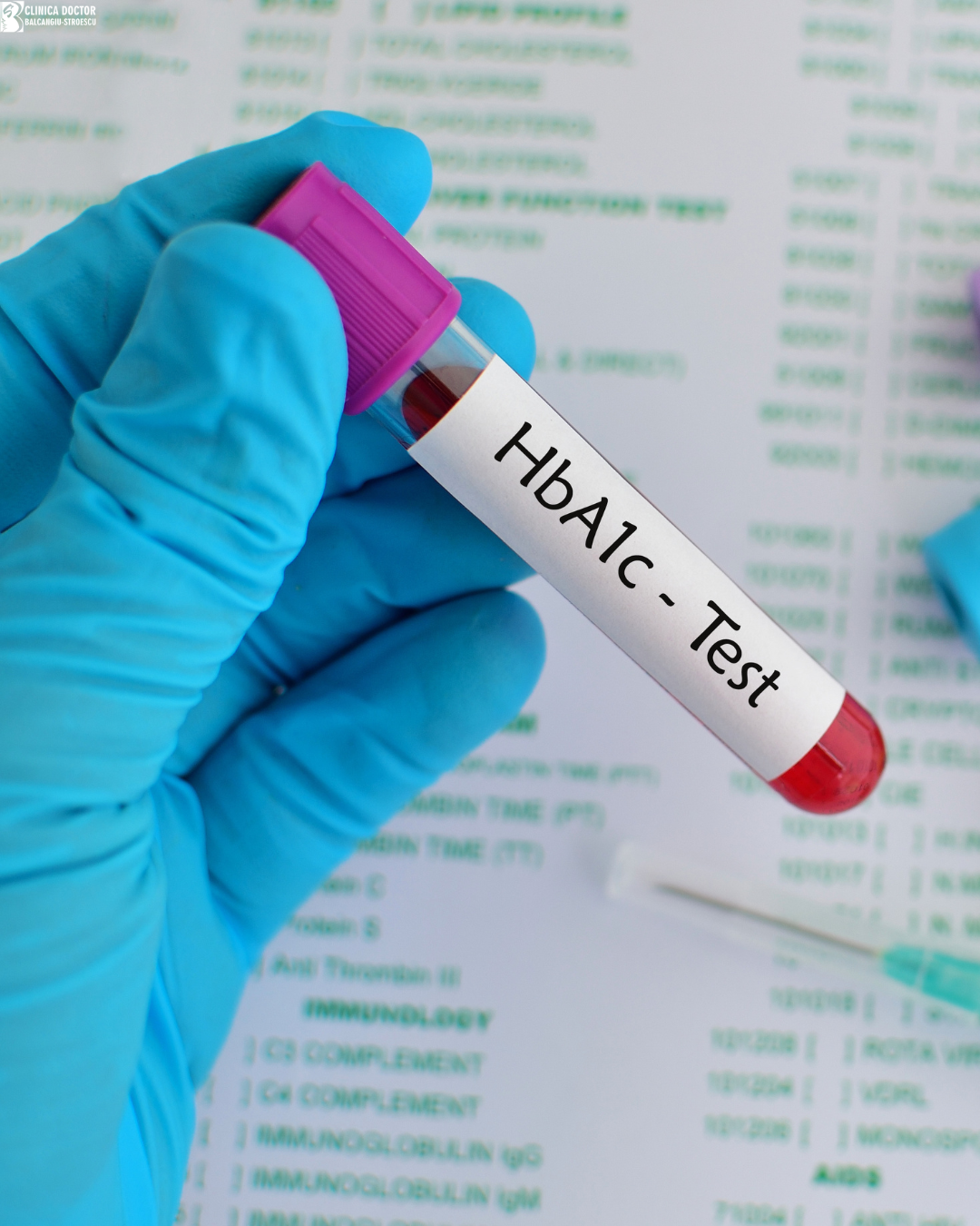 Determinare hemoglobină glicată (HbA1c) în cabinet – sânge capilar