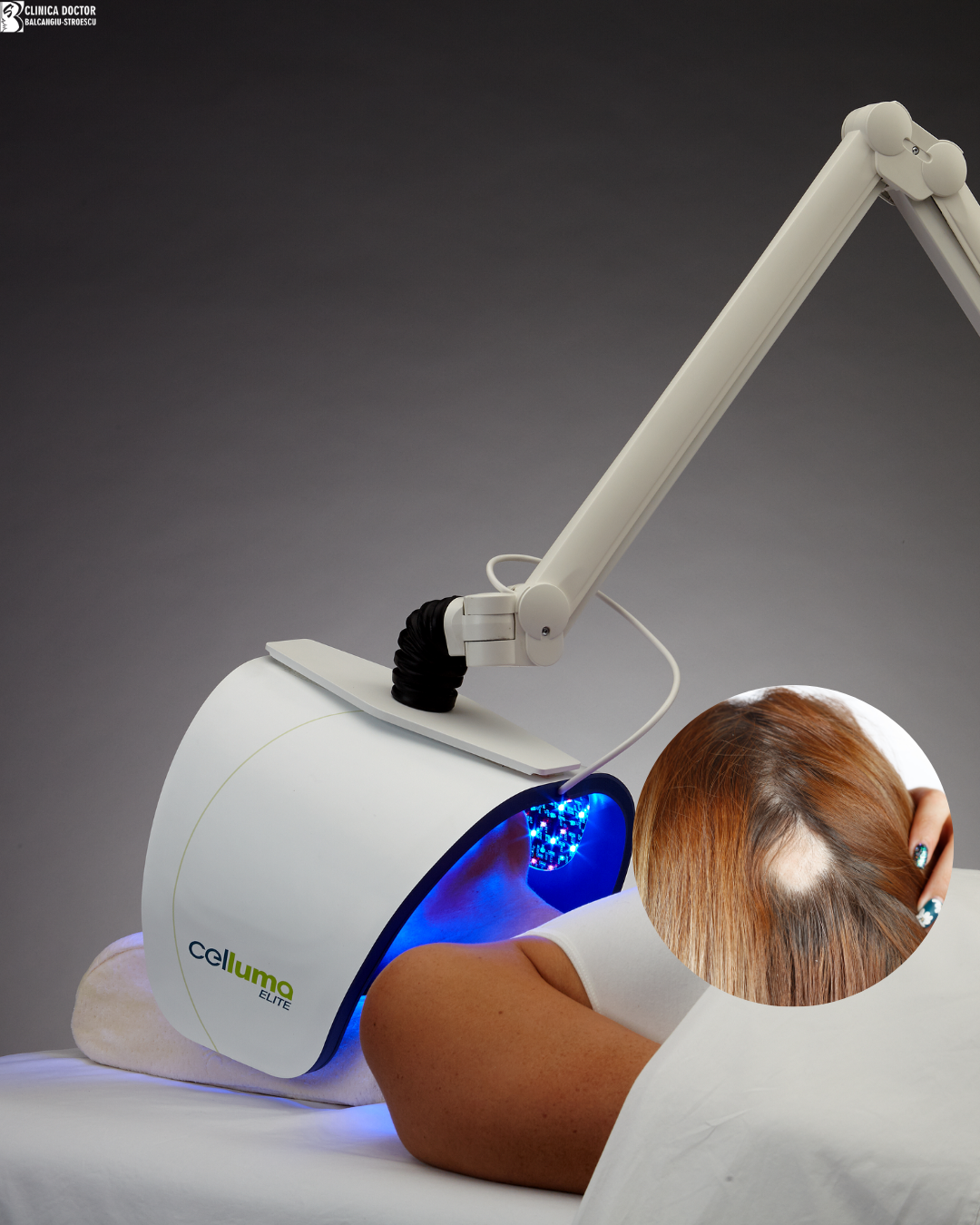 Celluma lamp red light – post-rejuvenation recovery and alopecia (6+2 sessions) Celluma lamp red light – post-rejuvenation recovery and alopecia (6+2 sessions)