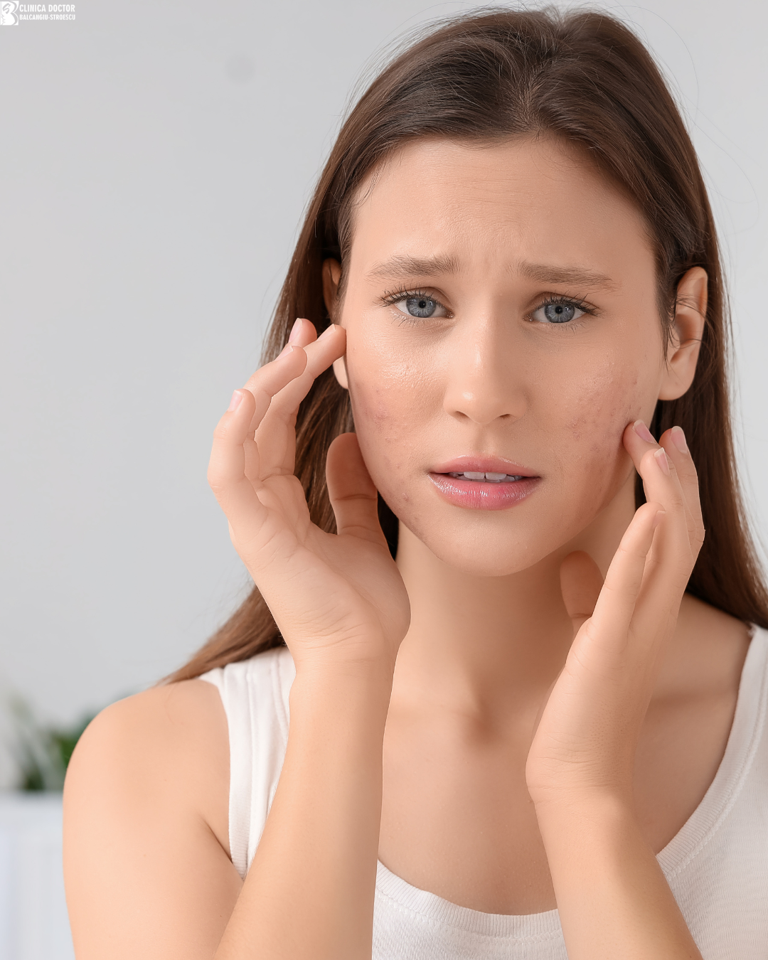 Psychological support in dermatological conditions Psychological support in dermatological conditions
