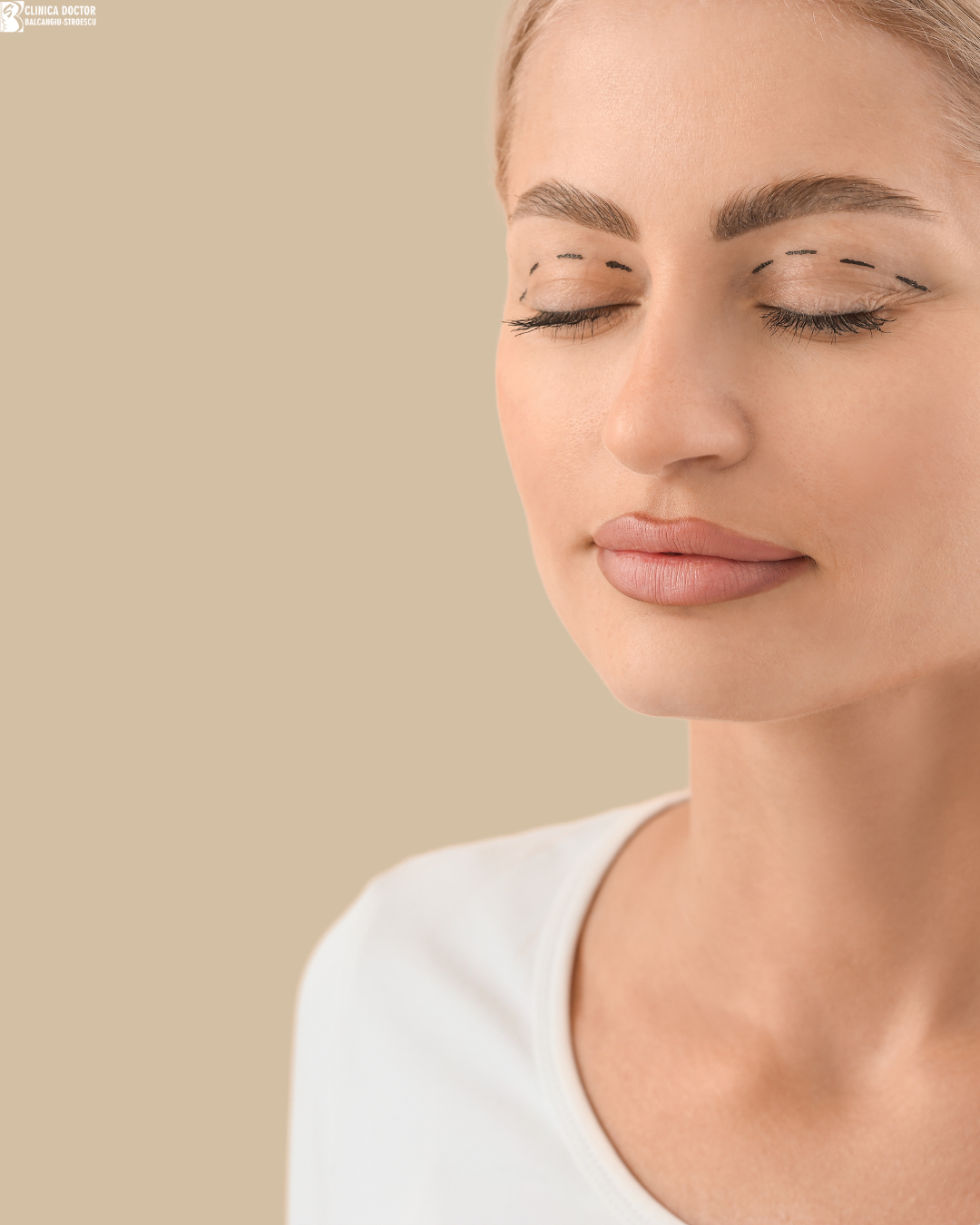 Upper blepharoplasty under local anesthesia - specialist physician Upper blepharoplasty under local anesthesia - specialist physician
