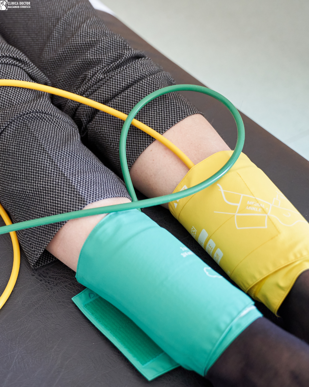 Ankle-brachial index (ABI) measurement – assessment of peripheral arterial circulation
