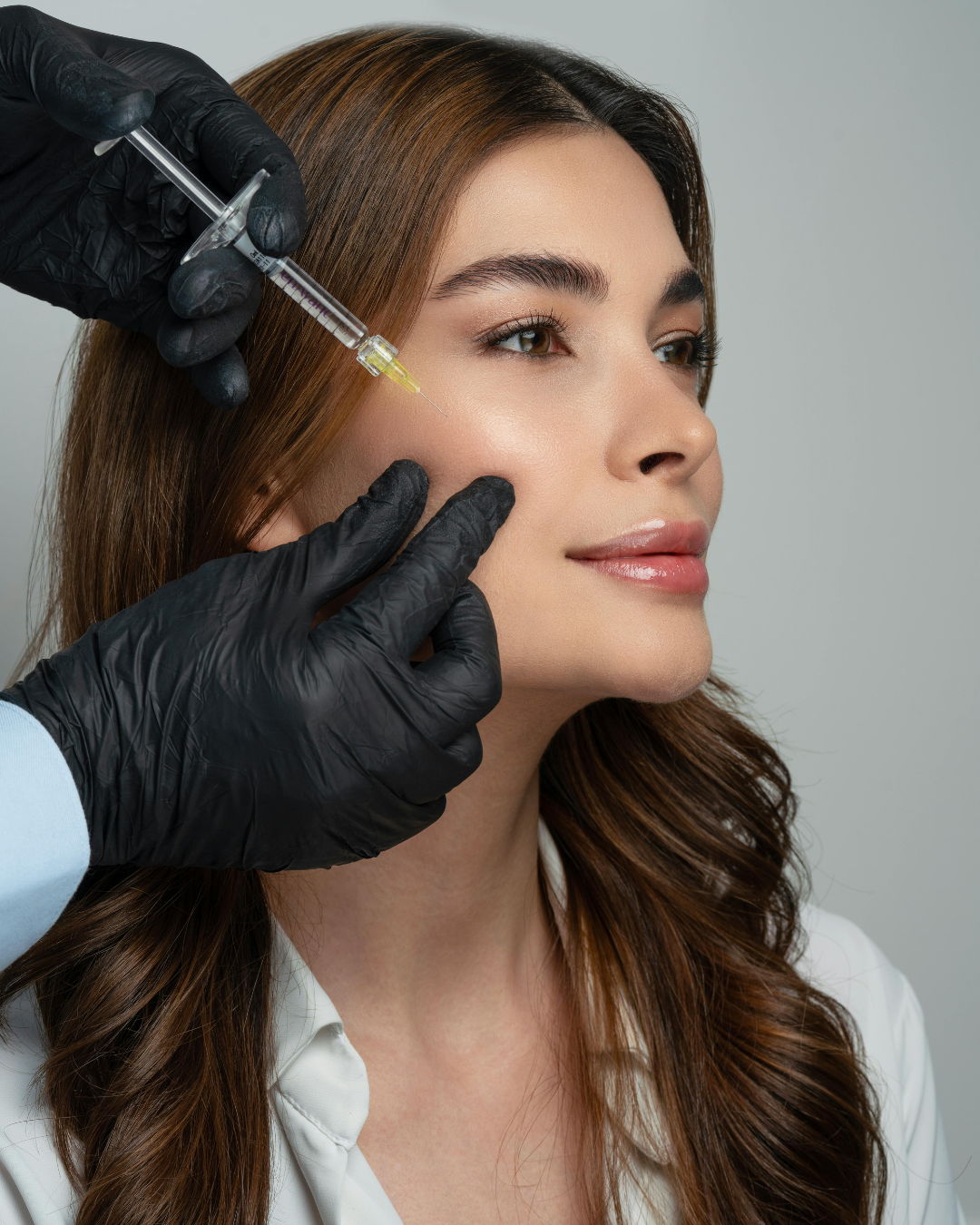 PRP  – tratament regenerativ cu plasmă bogată în trombocitela la nivelul labiilor (rejuvenarea labială)