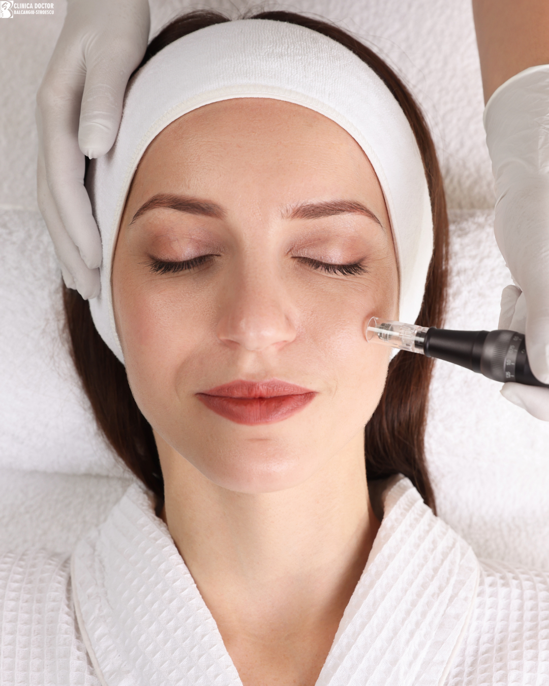 Mesotherapy with vitamin cocktail (NCTF,  Mesoestetic) – 1 zone