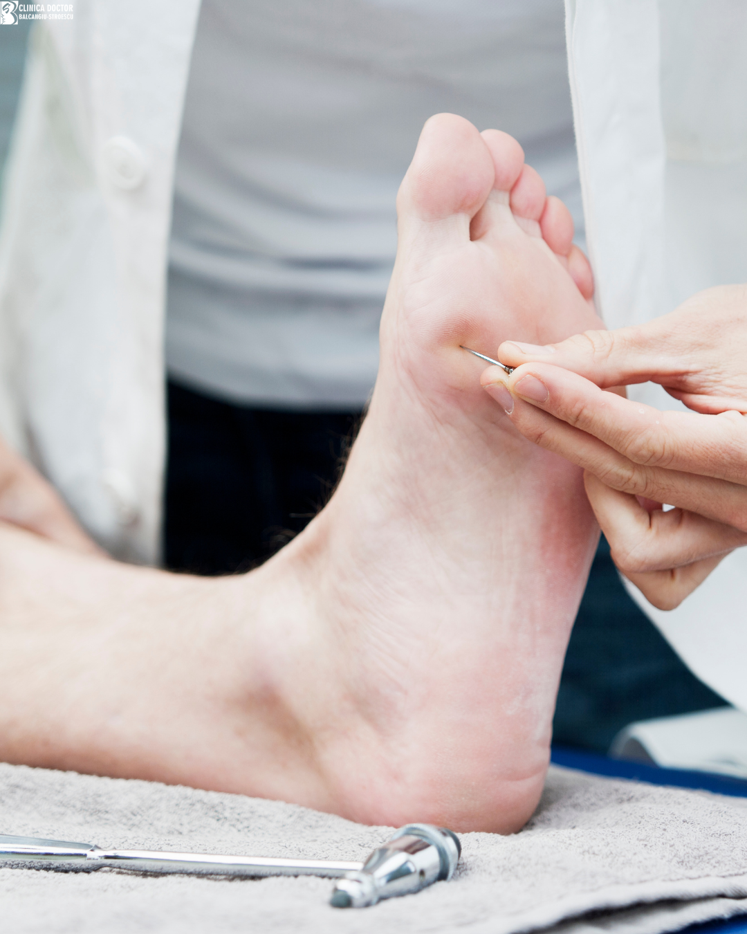 Screening tests for diabetic neuropathy