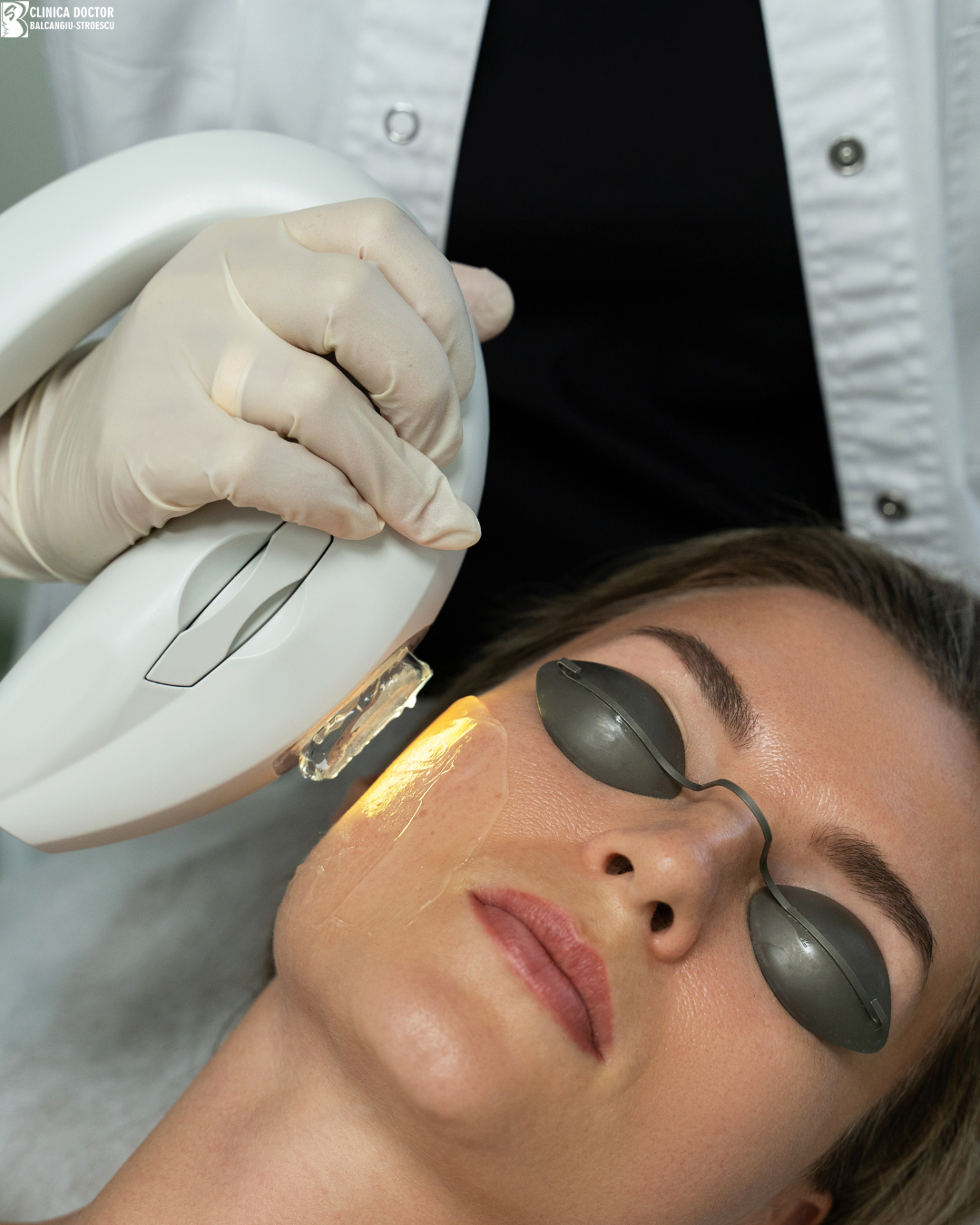 Laser vascular: ce este, cum funcționează și la ce să te aștepți
