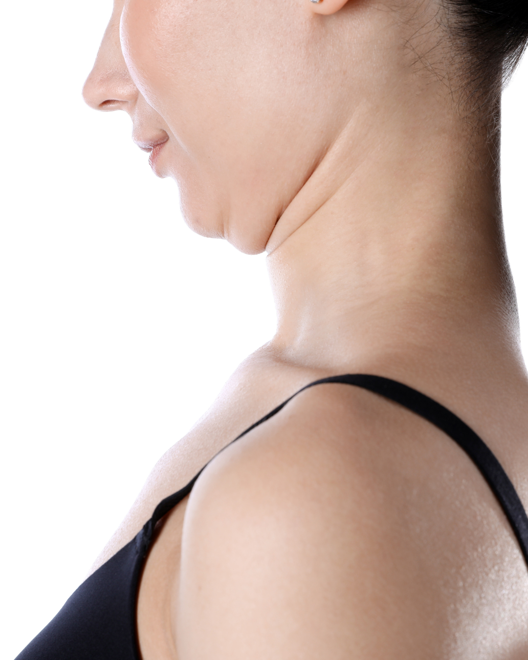 Lipoliză double chin,corporal cu acid deoxicolic (Lipolax)