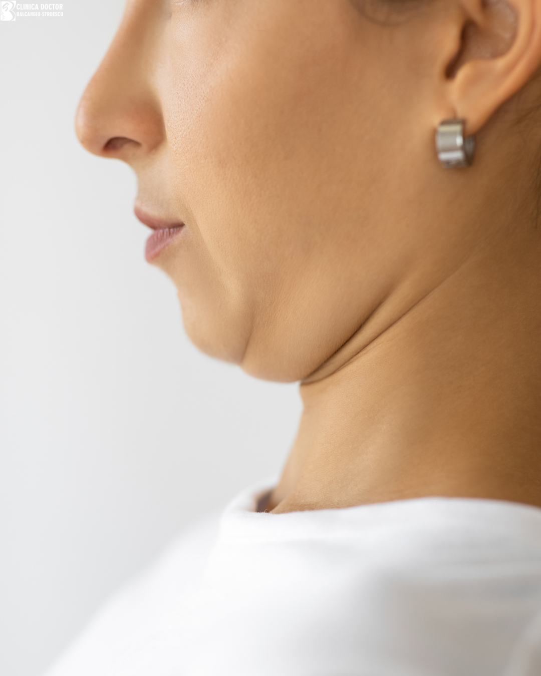 PB Serum – double chin treatment PB Serum – double chin treatment