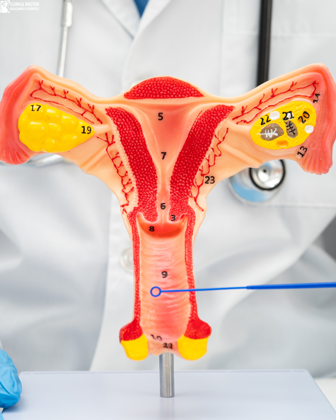 Vaginal rejuvenation Exion Vaginal rejuvenation Exion