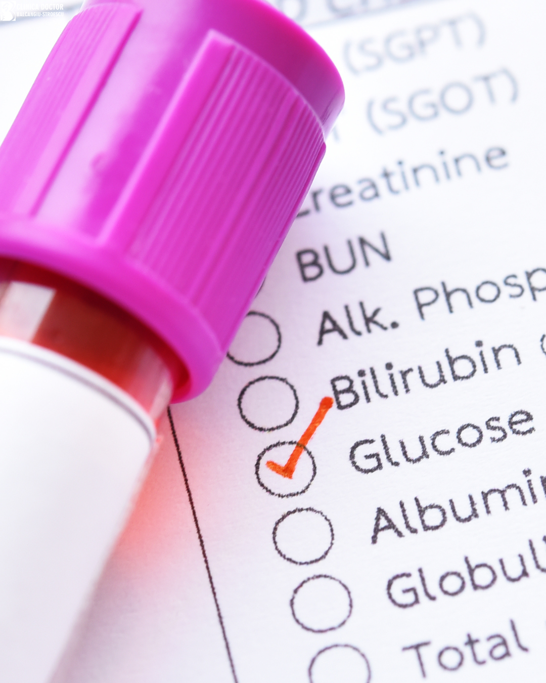 OGTT (oral glucose tolerance test): preparation, normal values and interpretation