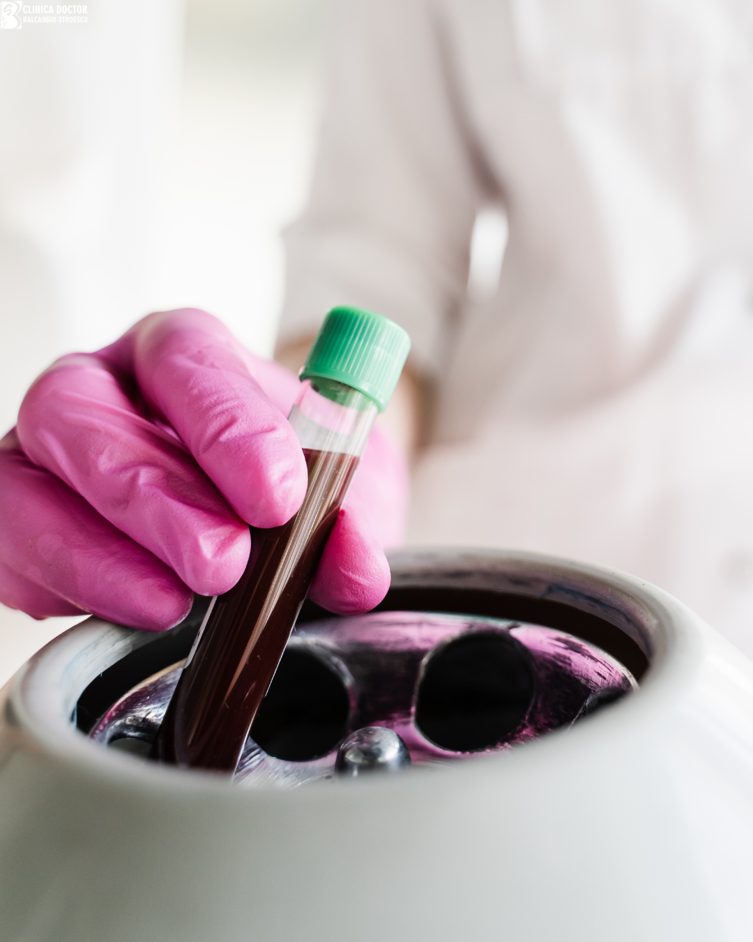 PRP Treatment for Urological Corpus Cavernosum PRP Treatment for Urological Corpus Cavernosum