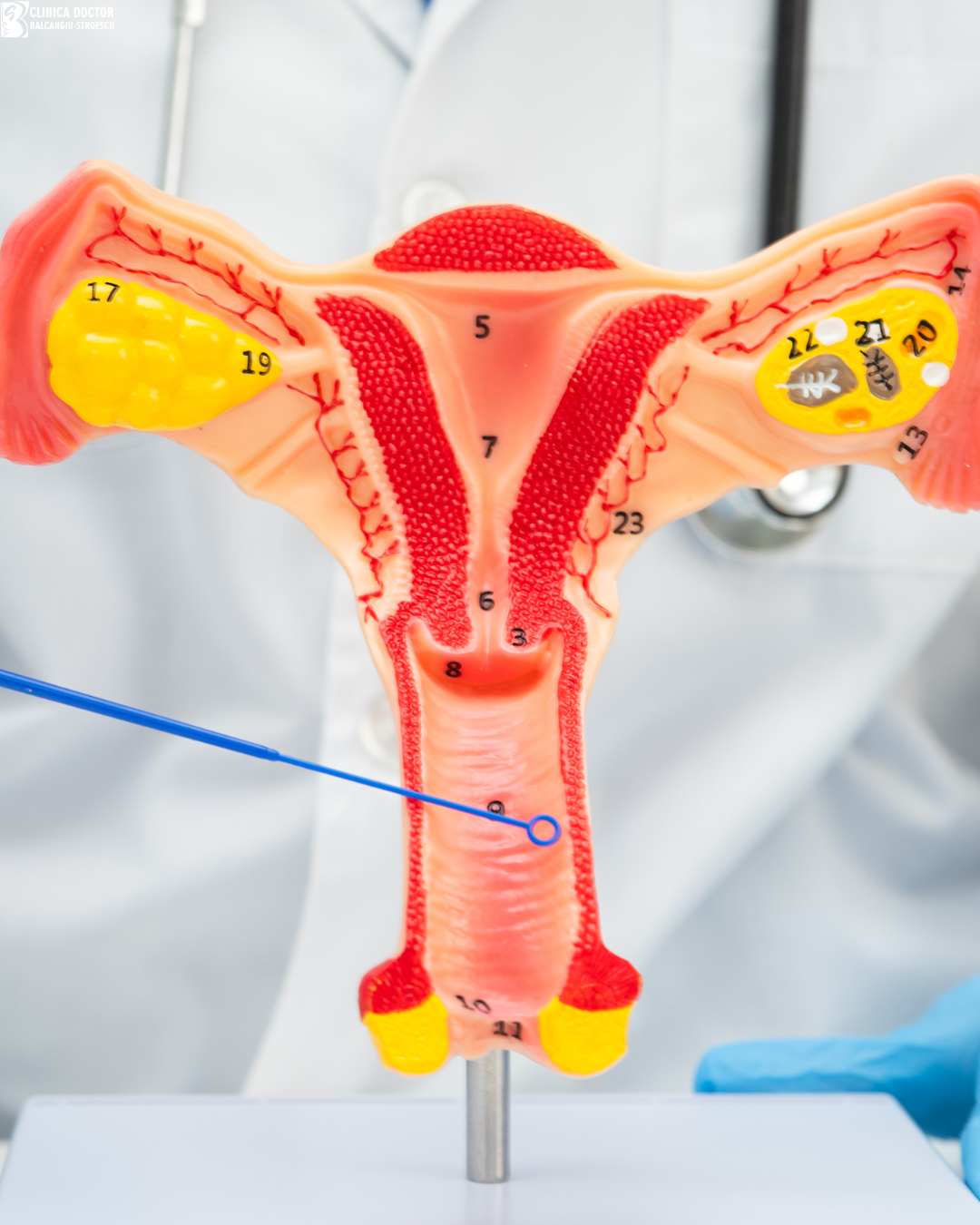 Hybrid CO2 laser treatment vaginal rejuvenation