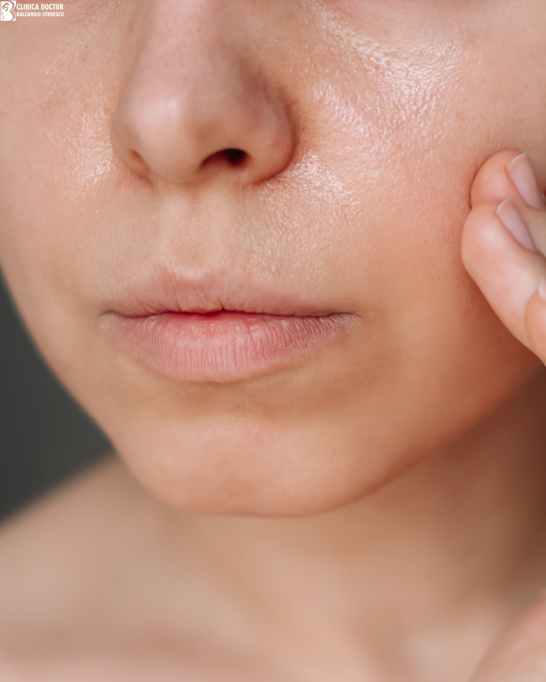 Tratament laxitate cutanată – laser ClearLift QS Nd:YAG 1064 nm