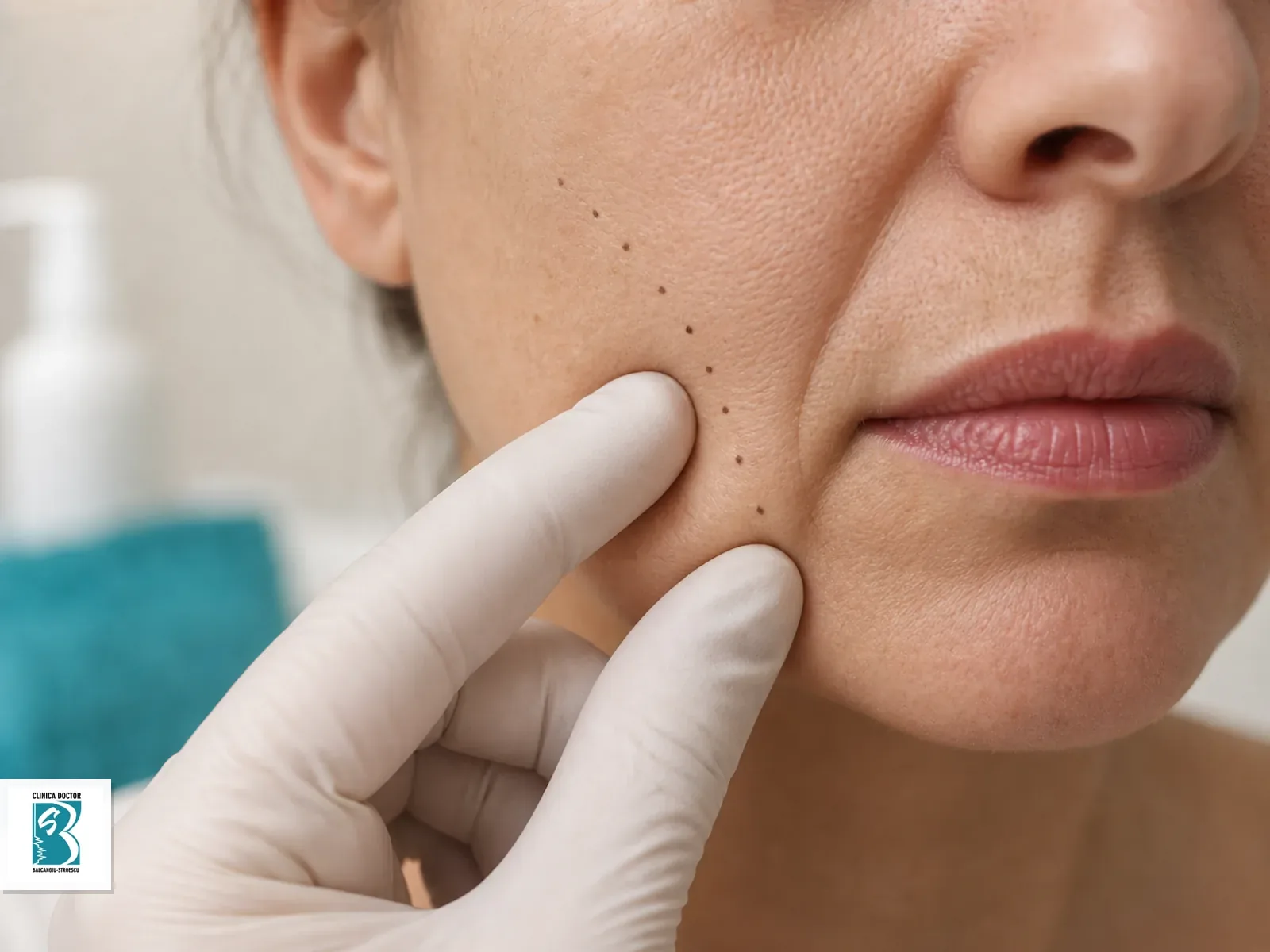 Laxitate faciala si piele lasata - consultatie medic specialist Testarea elasticitatii pielii obrazului cu marcaje fine de planificare