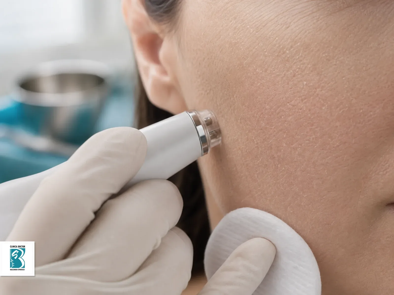 Piele terna si deshidratata - consultatie medic primar Evaluarea hidratarii pielii terne cu sonda dermatologica pe zona obrazului