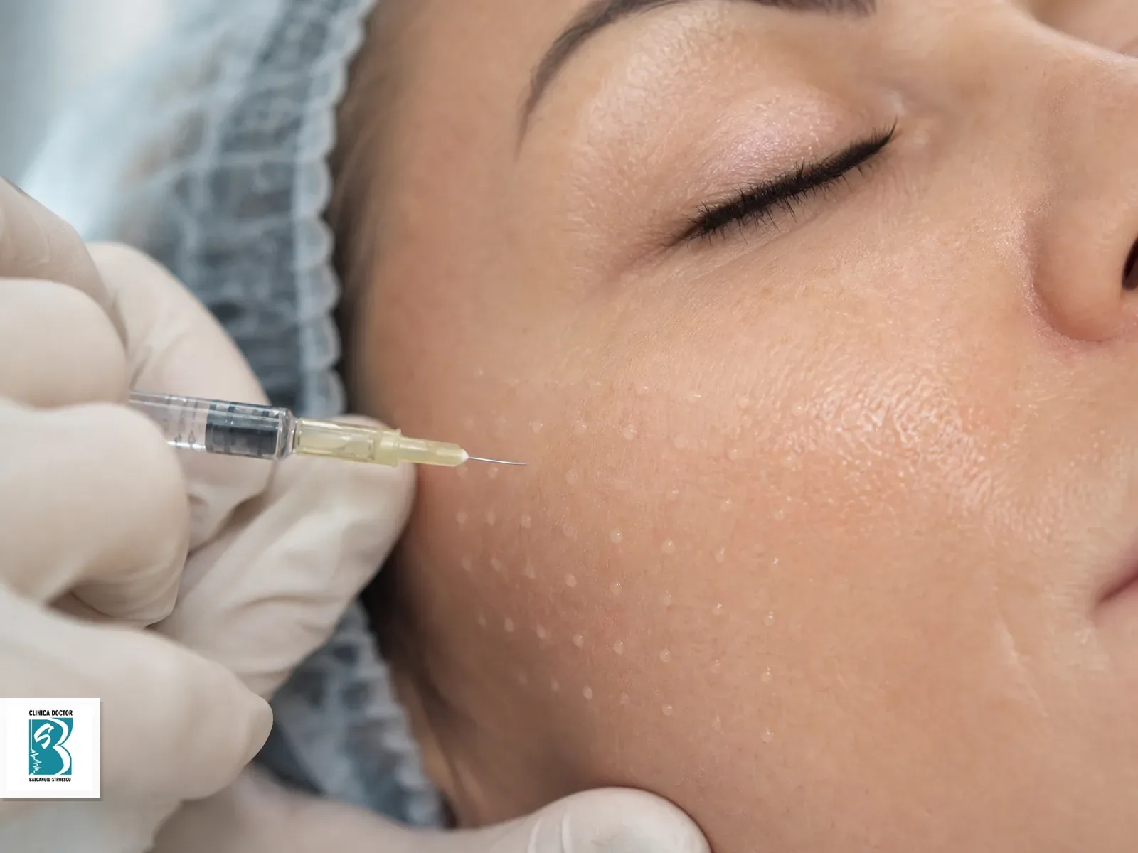 Mezoterapie cu cocktail de vitamine pe o zona a obrazului cu microinjectii fine
