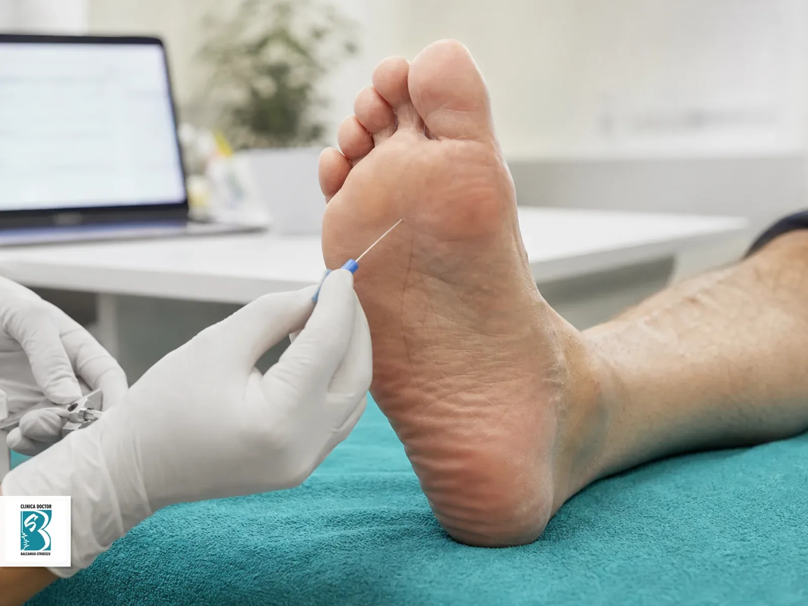 Screening pentru neuropatie diabetica prin evaluarea piciorului