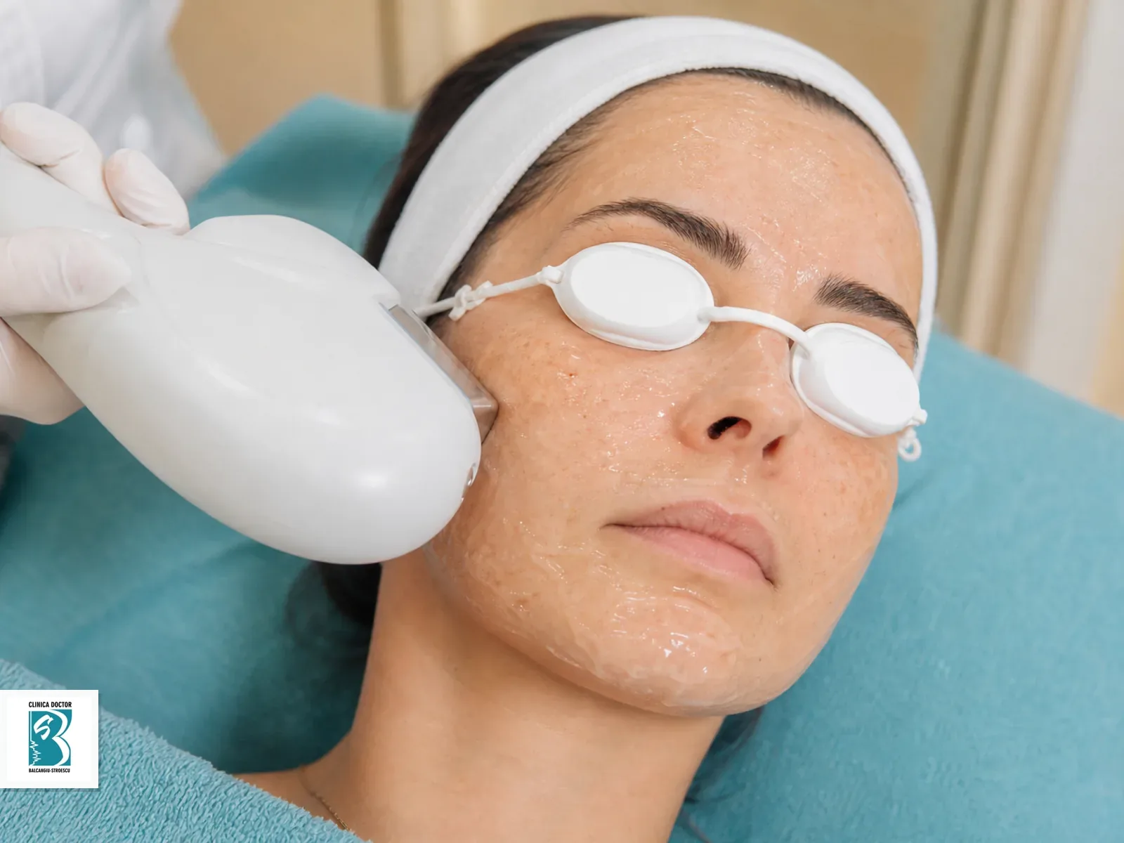 IPL Tight & Bright - Hiperpigmentari, Pete Pigmentare, Luminozitate - fata integral Tratament IPL Tight & Bright pentru intregii fete, cu pete pigmentare evaluate in cadru clinic