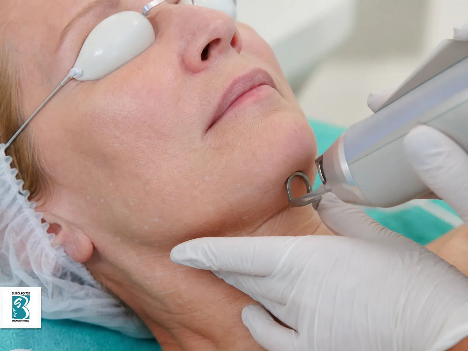 Tratament laser ClearLift pentru laxitate cutanata pe linia mandibulei