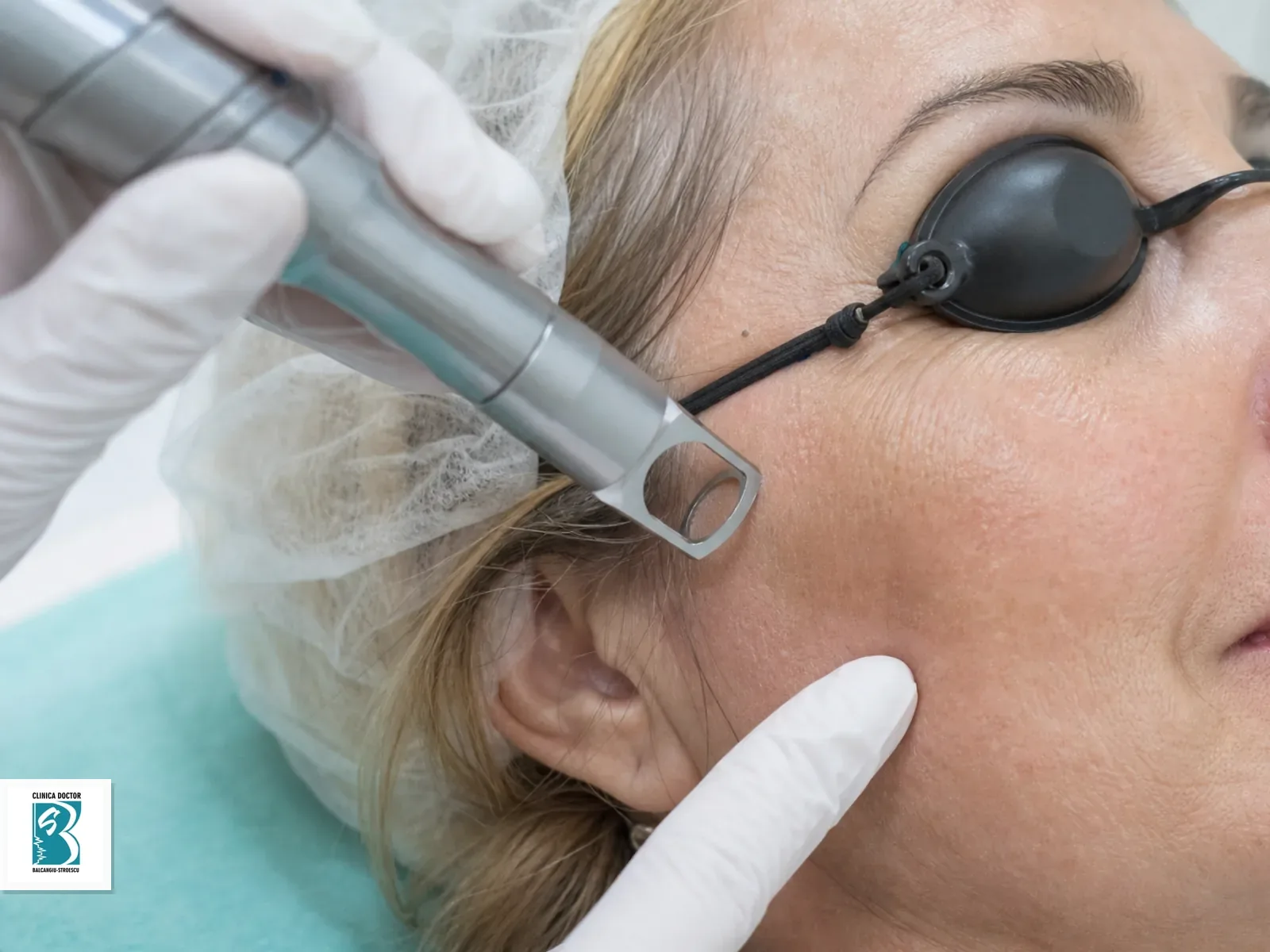 Tratament ClearLift pentru riduri fine full face