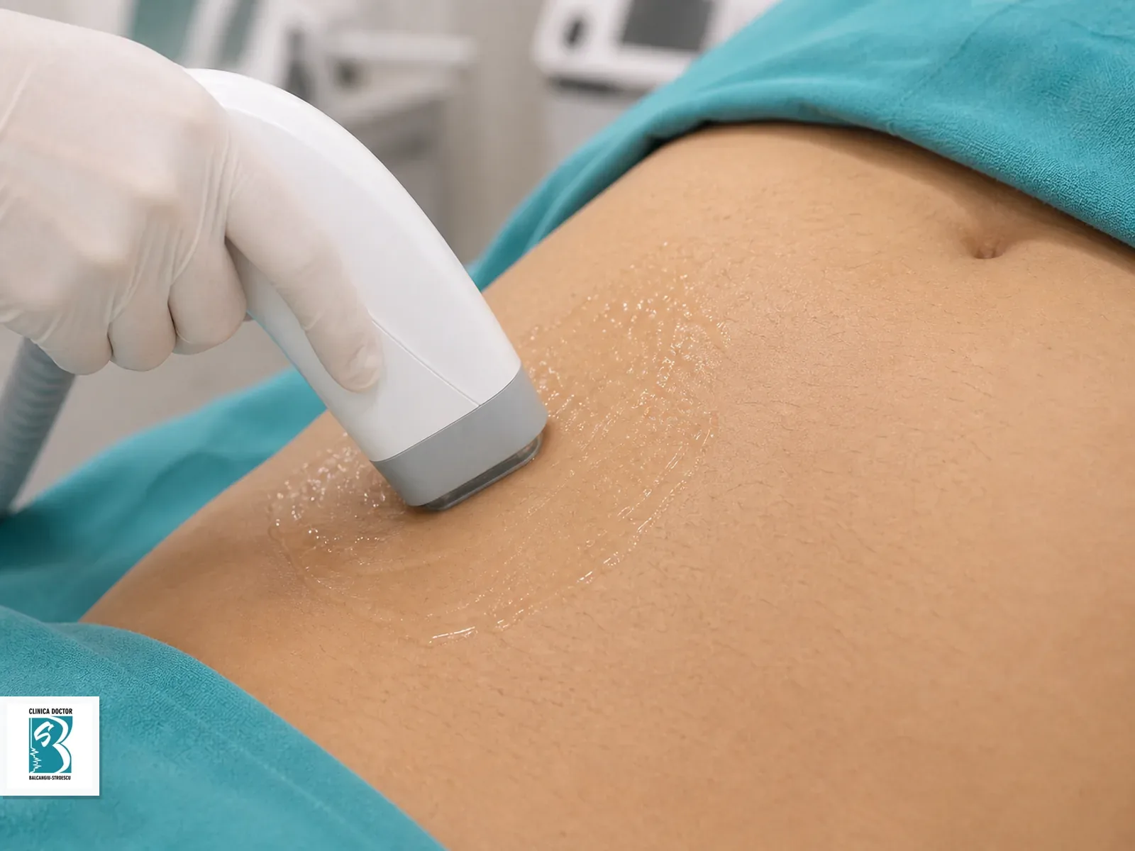 Abdomen Aplicator de epilare laser pentru Abdomen, cu gel de protecție pe zona tratată