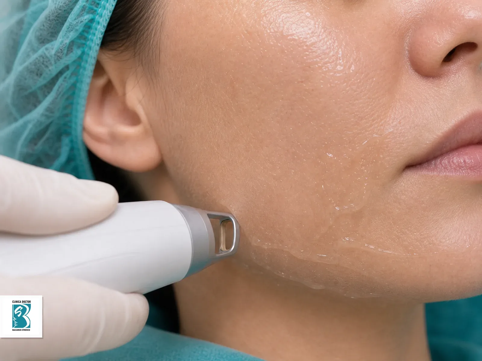 Aplicator de epilare laser pentru Fața full, cu gel de protecție pe zona tratată