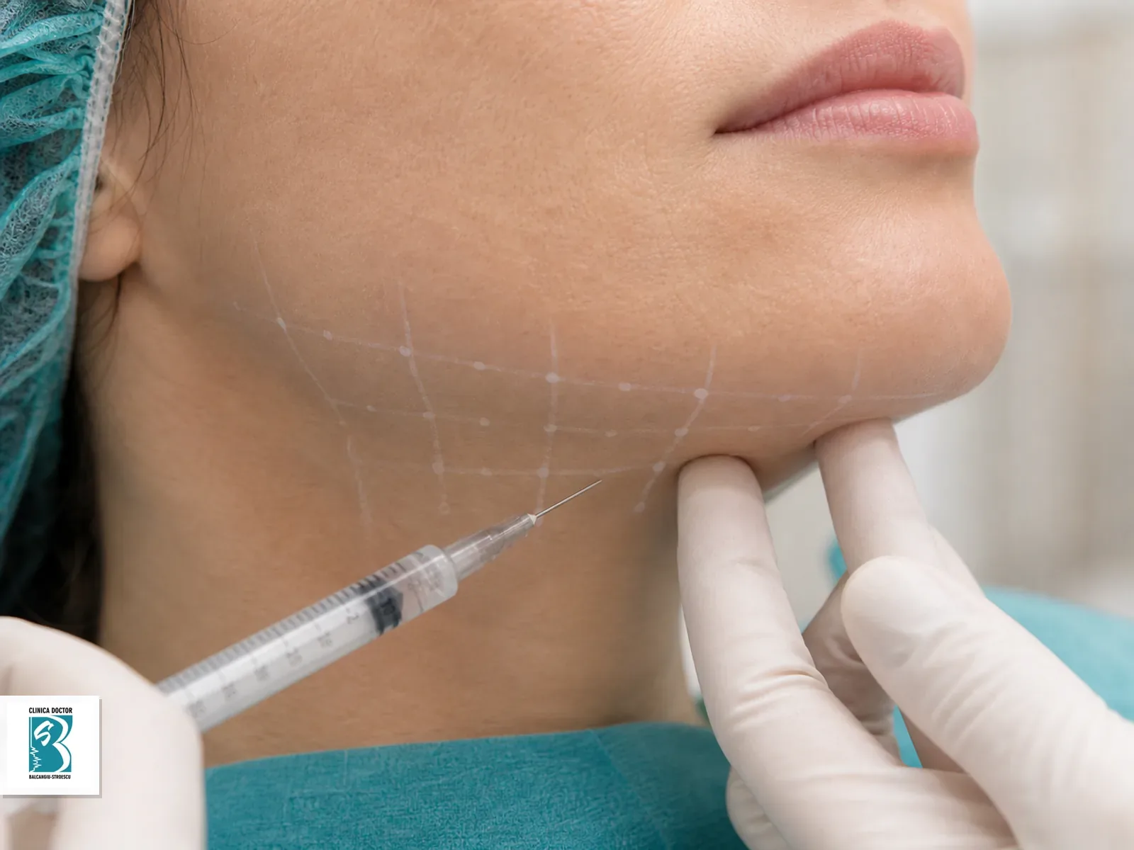 Tratament PB Serum pentru PB Serum – tratament bărbie dublă (double chin), cu marcaje clinice și administrare locală