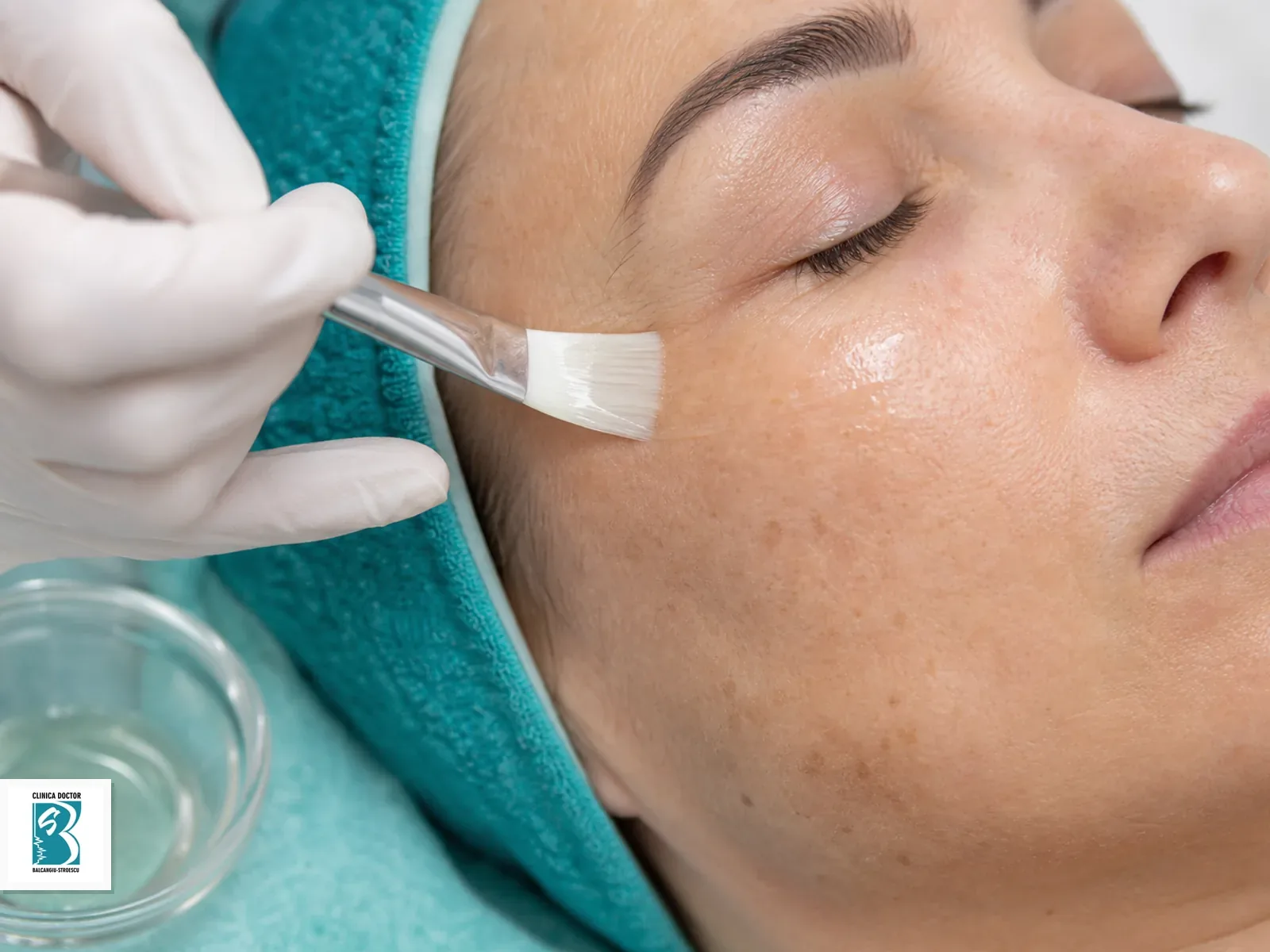 Peeling chimic profesional (Retibooster/Smart DNA/All eye/Peptiglow/R,Pen /Mediderma, Melaspil, Salipil, Target Nanopeal, Perulac ) Aplicare controlată de tratament cutanat pentru Peeling chimic profesional (Retibooster/Smart DNA/All eye/Peptiglow/R,Pen /Mediderma, Melaspil, Salipil, Target Nanopeal, Perulac ), pe piele pregătită clinic