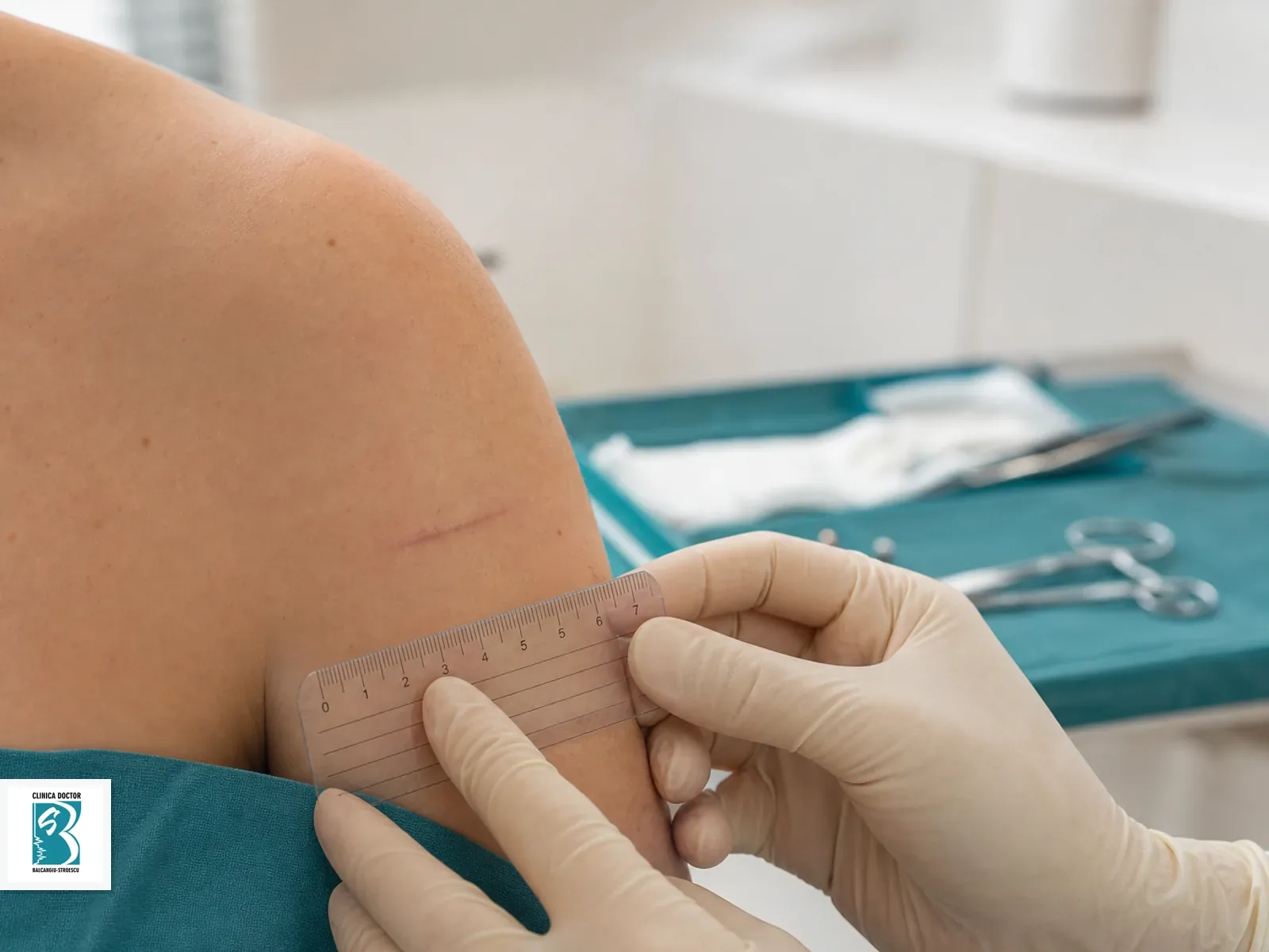 Control medic primar chirurgie plastica Control de chirurgie plastica medic primar, verificarea vindecarii dupa interventie